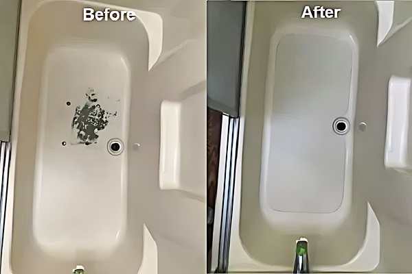 inlay before after